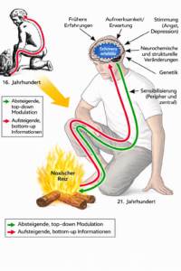 Illustration zum Vergleich alter und moderner Ansichten über Schmerzen: Eine alte Zeichnung zeigt einen einfachen Weg vom Feuer zum Gehirn, während ein modernes Bild komplexe Wechselwirkungen im Gehirn zeigt, an denen Genetik, Stimmung und frühere Erfahrungen beteiligt sind.